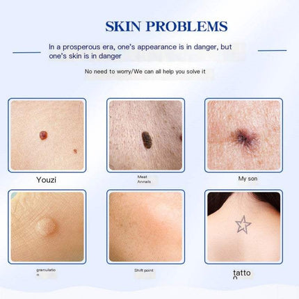 Beauty Device Home Spot Removal Pen with LCD display for adjustable skincare spot removal