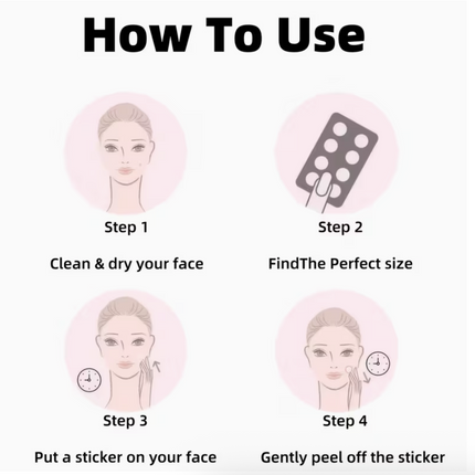 Black pimple covers by UK Dropships, 160pcs, gentle, alcohol-free acne patches in light beige for sensitive skin care.