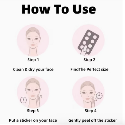 Black pimple covers by UK Dropships, 160pcs, gentle, alcohol-free acne patches in light beige for sensitive skin care.