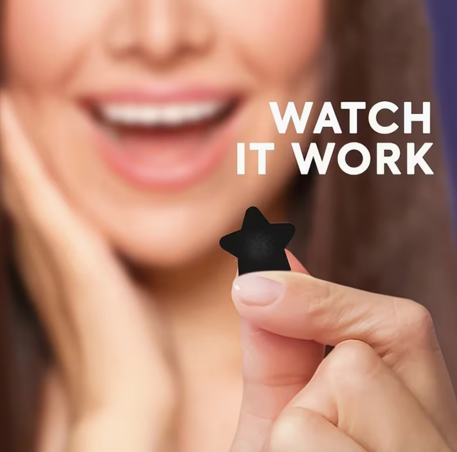 Set of 160 black pimple covers for sensitive skin, alcohol-free, fragrance-free, pore-cleansing acne patches in sleek packaging.