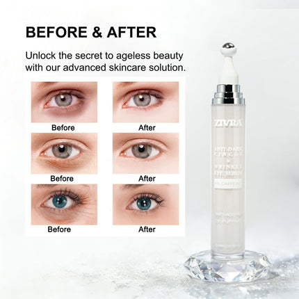 ZIVRA Anti Dark Circle Eye Serum – 5% Caffeine | Anti-Ageing & De-Puffing | 20ml | 360° Roller Applicator