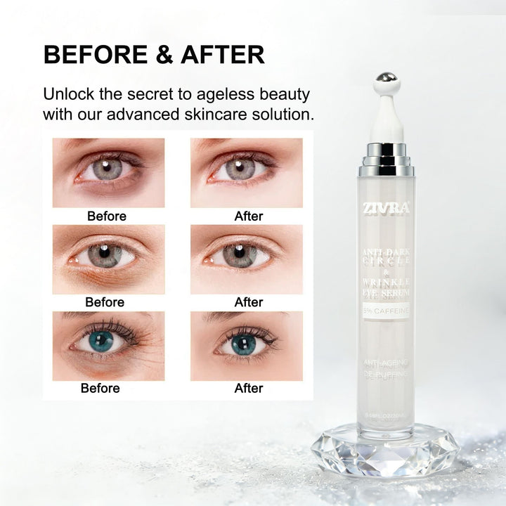 ZIVRA Anti Dark Circle Eye Serum – 5% Caffeine | Anti-Ageing & De-Puffing | 20ml | 360° Roller Applicator