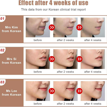 Microcurrent Face Lifting Massager for Skin Rejuvenation